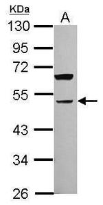 PARVA Antibody in Western Blot (WB)