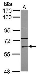 TKTL2 Antibody in Western Blot (WB)