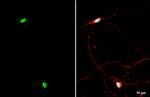 NFIX Antibody in Immunocytochemistry (ICC/IF)