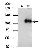 WBP11 Antibody in Immunoprecipitation (IP)