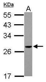 PSMG1 Antibody in Western Blot (WB)