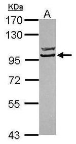 STRN3 Antibody in Western Blot (WB)