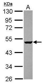 GABPB2 Antibody in Western Blot (WB)