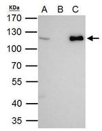 CHD1L Antibody in Immunoprecipitation (IP)