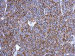 OVCA2 Antibody in Immunohistochemistry (Paraffin) (IHC (P))