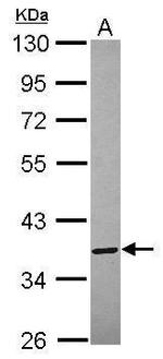 Annexin A8 Antibody in Western Blot (WB)