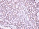 MRPS10 Antibody in Immunohistochemistry (Paraffin) (IHC (P))