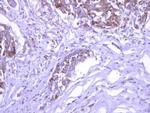 EXOC1 Antibody in Immunohistochemistry (Paraffin) (IHC (P))