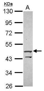 ZNF645 Antibody in Western Blot (WB)