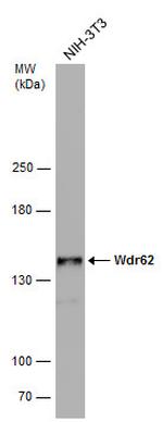 WDR62 Antibody in Western Blot (WB)