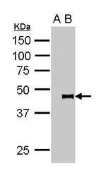 PYGO2 Antibody in Immunoprecipitation (IP)