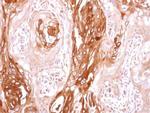 SEC23B Antibody in Immunohistochemistry (Paraffin) (IHC (P))