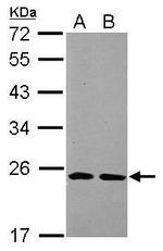 THOC7 Antibody in Western Blot (WB)