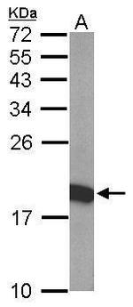 THOC7 Antibody in Western Blot (WB)