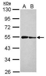 ST3GAL3 Antibody in Western Blot (WB)