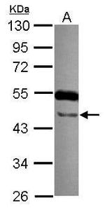 TTLL10 Antibody in Western Blot (WB)