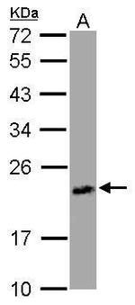 UPRT Antibody in Western Blot (WB)