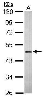 LYPLA3 Antibody in Western Blot (WB)