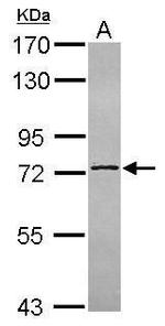C14orf21 Antibody in Western Blot (WB)
