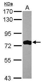 ASMTL Antibody in Western Blot (WB)