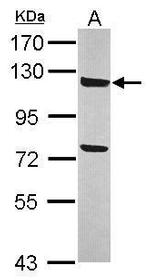 ANKLE2 Antibody in Western Blot (WB)