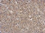 ARPC5L Antibody in Immunohistochemistry (Paraffin) (IHC (P))