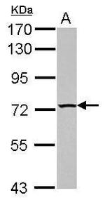 TBC1D15 Antibody in Western Blot (WB)