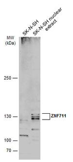 ZNF711 Antibody in Western Blot (WB)