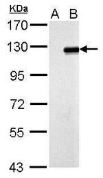 ZNF711 Antibody in Western Blot (WB)