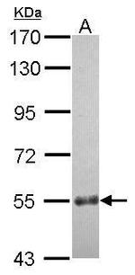 CCDC7 Antibody in Western Blot (WB)