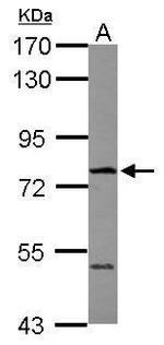 FBXO21 Antibody in Western Blot (WB)