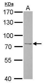 FBXO21 Antibody in Western Blot (WB)