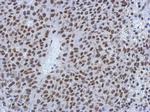 MIER3 Antibody in Immunohistochemistry (Paraffin) (IHC (P))