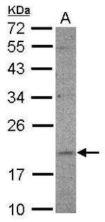 UFC1 Antibody in Western Blot (WB)