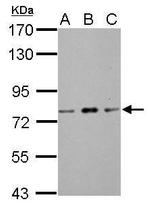 ZBTB20 Antibody in Western Blot (WB)