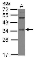 METTL6 Antibody in Western Blot (WB)