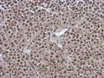 ORP9 Antibody in Immunohistochemistry (Paraffin) (IHC (P))