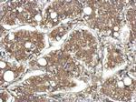 CYFIP1 Antibody in Immunohistochemistry (Paraffin) (IHC (P))