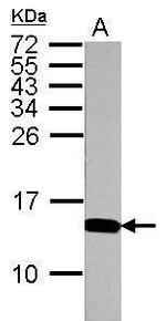 H4ac pan-acetyl (K5,K8,K12,K16) Antibody in Western Blot (WB)