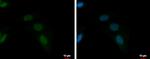 ZFAT Antibody in Immunocytochemistry (ICC/IF)