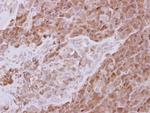 ATG13 Antibody in Immunohistochemistry (Paraffin) (IHC (P))