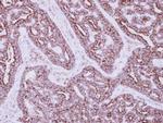 HIBADH Antibody in Immunohistochemistry (Paraffin) (IHC (P))