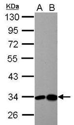 HIBADH Antibody in Western Blot (WB)