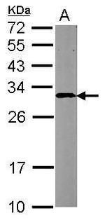 CBR4 Antibody in Western Blot (WB)