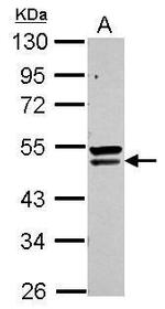 QTRTD1 Antibody in Western Blot (WB)