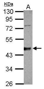 CK1 delta Antibody in Western Blot (WB)