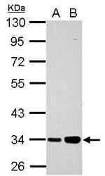 PARP16 Antibody in Western Blot (WB)