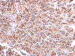 ST8SIA4 Antibody in Immunohistochemistry (Paraffin) (IHC (P))