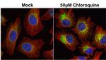 LC3B Antibody in Immunocytochemistry (ICC/IF)