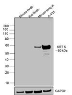 Cytokeratin 5 Antibody